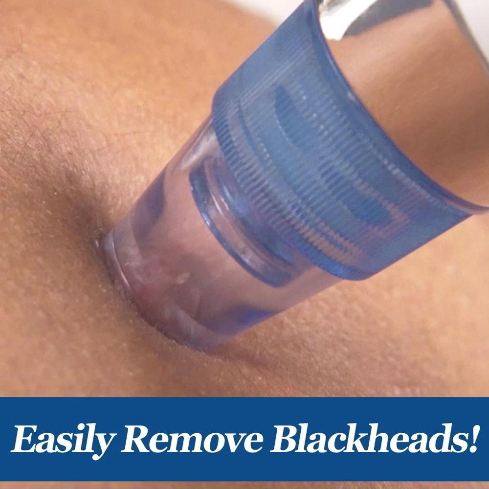 Blackhead and Pore Vacuum Cleaner
